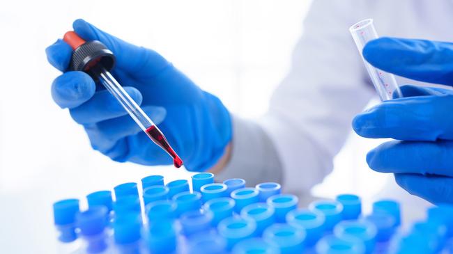 verweist auf: Paul-Ehrlich-Institut zum EU-Referenzlabor für In-vitro-Diagnostika zum Nachweis von Markern für Blutgruppen benannt Blutprobe im Labor