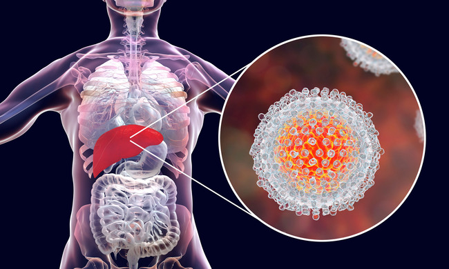 Hepatitis C Virus (Quelle: Kateryna Kon/Shutterstock.com)