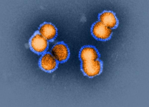 Pandemische Influenza H5N1-Viren (Quelle: K.Boller/Paul-Ehrlich-Institut) (verweist auf: Sicherheit von biome-
dizinischen Arzneimit-
teln und Diagnostika)