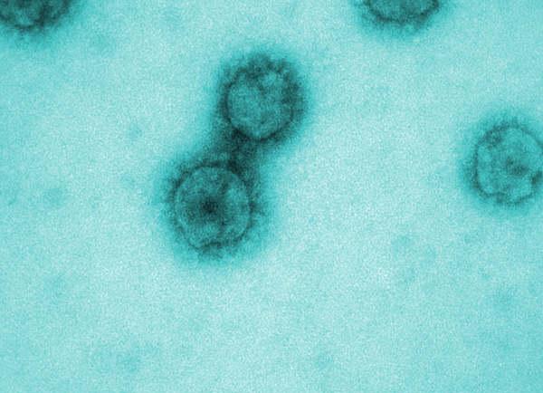 SARS-CoV-2-Viren (Quelle: J.Krijnse Locker/Paul-Ehrlich-Institut) (verweist auf: Elektronenmikroskopie von Pathogenen)