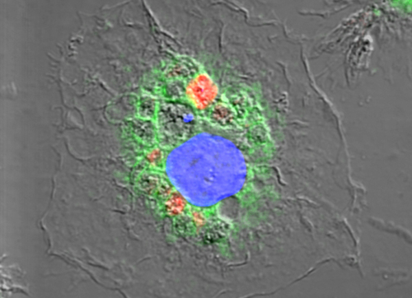 verweist auf: Immunologie Immunologie: Infektion durch Leishmanien (verweist auf: Immunologie)