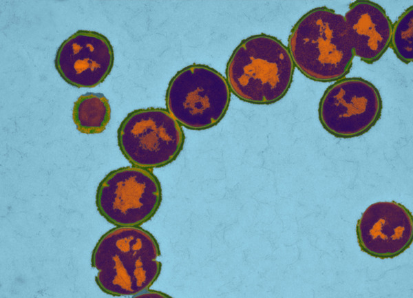 Staphylococcus pyrogenes (Quelle: K.Boller/Paul-Ehrlich-Institut) (verweist auf: Mikrobiologie)