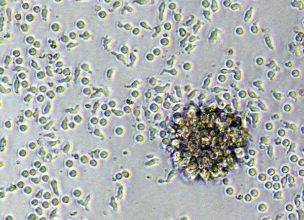 Car-T-Zellen (Quelle: J.Hartmann/PEI) (verweist auf: Molekulare Biotechnologie und Gentherapie)