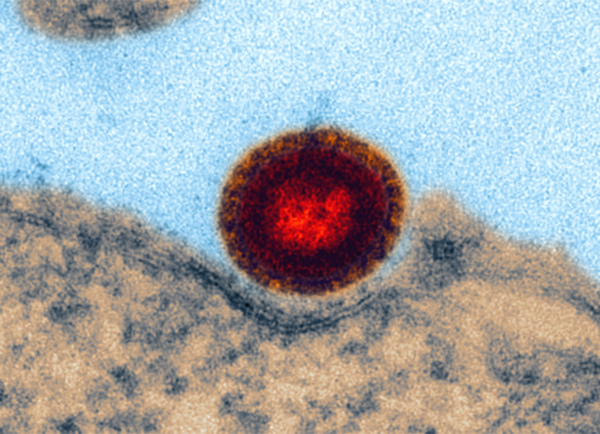 verweist auf: Veterinärmedizin Lentiviraler Vektor (Quelle: K.Boller/Paul-Ehrlich-Institut) (verweist auf: Veterinärmedizin)