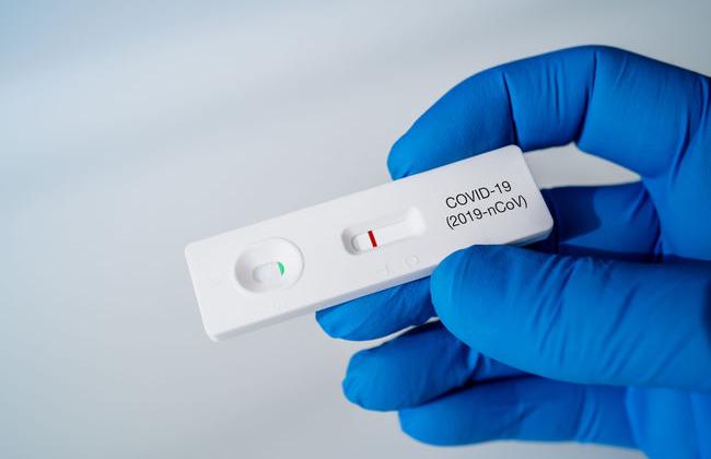 COVID-19 Antigen-Schnelltest (Quelle: ManuPadilla/Shutterstock.com) COVID-19 Antigen-Schnelltest (Quelle: ManuPadilla/Shutterstock.com)
