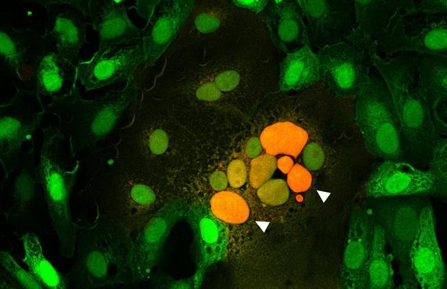 Microscopic  image of cells fused by the spike protein. The arrows point to the attachment of cell cores from several fused cells to each other (orange).  Microscopic  image of cells fused by the spike protein. The arrows point to the attachment of cell cores from several fused cells to each other (orange).