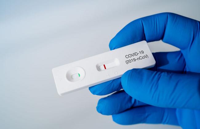 COVID-19 Rapid antigen tests (Source: ManuPadilla/Shutterstock.com) COVID-19 Rapid antigen tests (Source: ManuPadilla/Shutterstock.com)