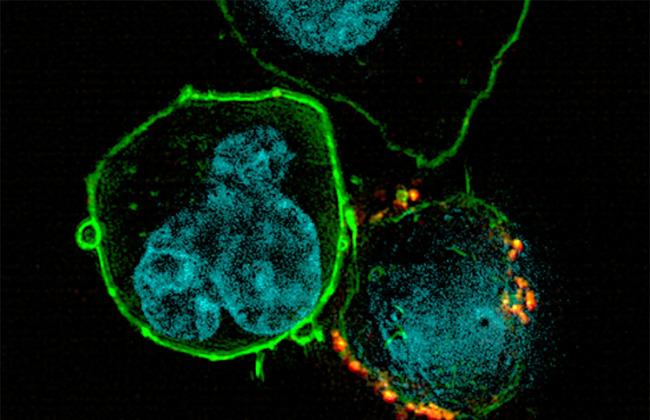 A tumour cell (left: cell core: blue, cell surface: green) is combated by a reprogrammed immune cell (right: synthetic chimeric antigen receptor, CAR: yellow). A tumour cell (left: cell core: blue, cell surface: green) is combated by a reprogrammed immune cell (right: synthetic chimeric antigen receptor, CAR: yellow).