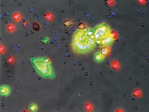 Monocytes infected with HIV-1 (yellow-green) and non-infected monocytes (red). Monocytes infected with HIV-1 (yellow-green) and non-infected monocytes (red).
