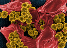 Figure: Methicillin-resistant Staphylococcus aureus (MRSA) (mustard-coloured) engulfed by a red coloured white blood cells (neutrophil granulocyte) Figure: Methicillin-resistant Staphylococcus aureus (MRSA) (mustard-coloured) engulfed by a red coloured white blood cells (neutrophil granulocyte)