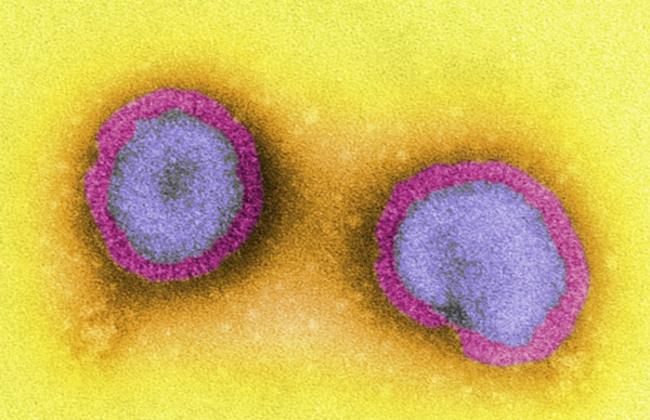 Electron microscope image of influenza virus (Source: K. Boller / PEI) Electron microscope image of influenza virus (Source: K. Boller / PEI)