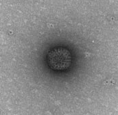 Electron micrograph of a rotavirus particle from the Rotarix vaccine  Electron micrograph of a rotavirus particle from the Rotarix vaccine