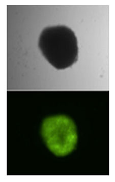 Stable gene transfer and expression of a Venus fluorescence marker gene mediated by Sleeping Beauty transposons in hematopoietic progenitor cells. Top: bright field image of a hematopoietic colony; bottom: Venus fluorescence of the same colony.  Stable gene transfer and expression of a Venus fluorescence marker gene mediated by Sleeping Beauty transposons in hematopoietic progenitor cells. Top: bright field image of a hematopoietic colony; bottom: Venus fluorescence of the same colony.