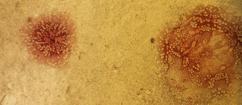 Cells infected with canine distemper virus fuse to neighboring uninfected cells to form syncytia. Antibodies against canine distemper virus are used to stain the infected cells with a red dye Cells infected with canine distemper virus fuse to neighboring uninfected cells to form syncytia. Antibodies against canine distemper virus are used to stain the infected cells with a red dye