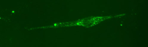 Cells infected with rabies virus were stained with antibodies from rabies-immunized animals. These cells can be seen by stimulating a fluorescent dye attached to the antibodies, which glows green. Cells infected with rabies virus were stained with antibodies from rabies-immunized animals. These cells can be seen by stimulating a fluorescent dye attached to the antibodies, which glows green.