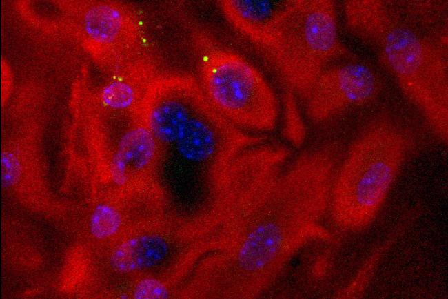 Allergen uptake Dendritic cells  Allergen uptake Dendritic cells